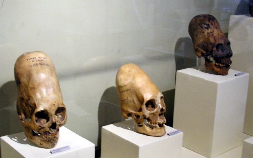 Más cráneos de Ica, Perú (Fuente)